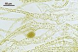 Leathesia mucosa var. condensata5